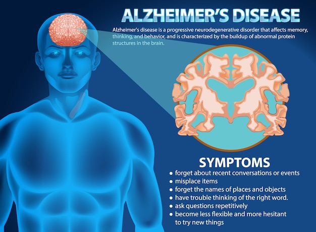 Cartel informativo de la enfermedad de alzheimer