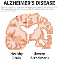 Vector gratuito cartel informativo de la enfermedad de alzheimer