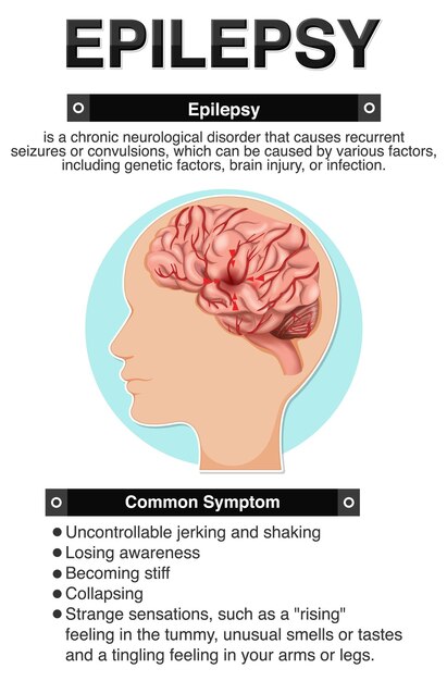 Cartel informativo de Epilepsia