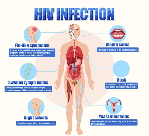 Vector gratuito cartel informativo de la infección por el vih