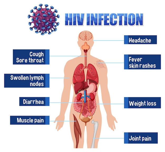 Vector gratuito cartel informativo de la infección por el vih