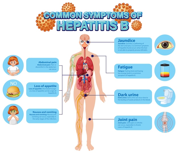 Cartel informativo de síntomas comunes Hepatitis B