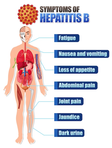Cartel informativo de síntomas comunes hepatitis b