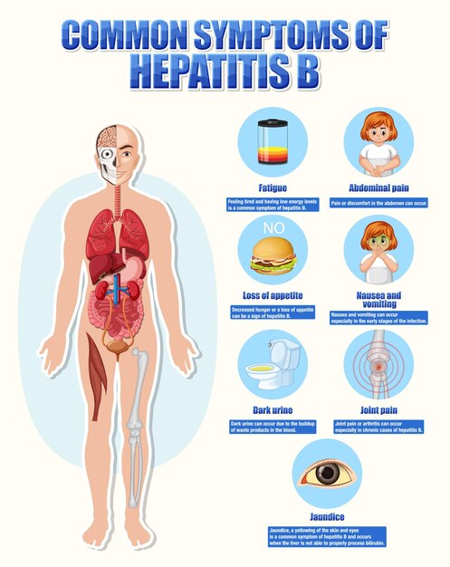 Cartel informativo de síntomas comunes Hepatitis B
