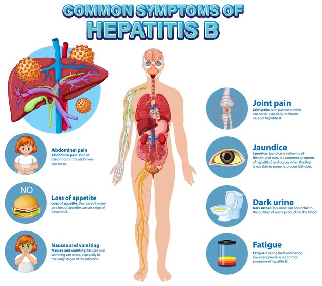 Cartel informativo de los síntomas comunes de la hepatitis B