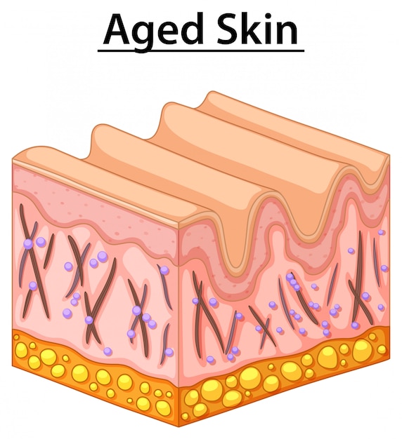 Cerrar diagrama de piel envejecida