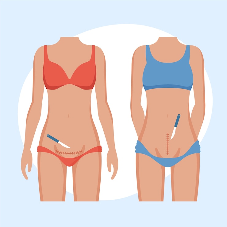Vector gratuito cesárea de diseño plano dibujado a mano
