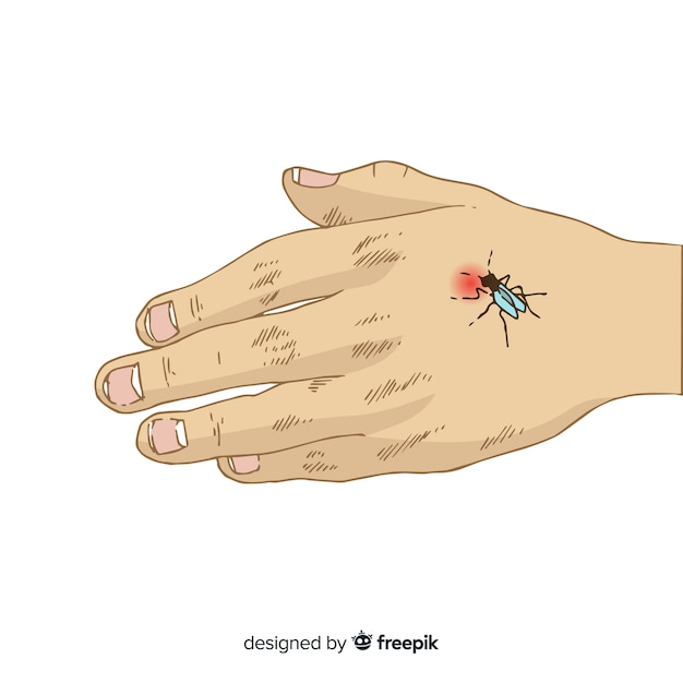 Composición de picadura de mosquito en la mano dibujada a mano