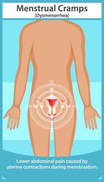 Comprender los calambres menstruales y la dismenorrea
