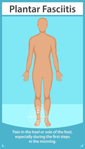 Comprender el dolor de la fasciitis plantar