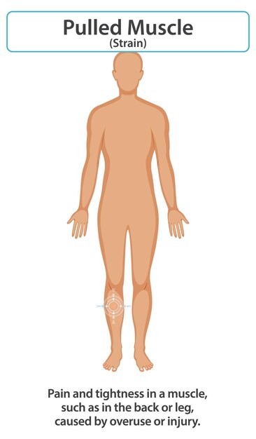 Comprender la tensión muscular y la recuperación