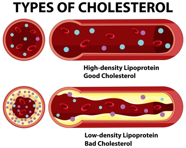 Comprender los tipos de colesterol
