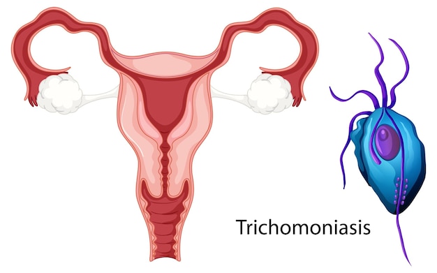 Vector gratuito concepto de bacterias de infección vaginal