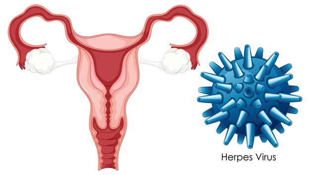 Concepto de bacterias de infección vaginal