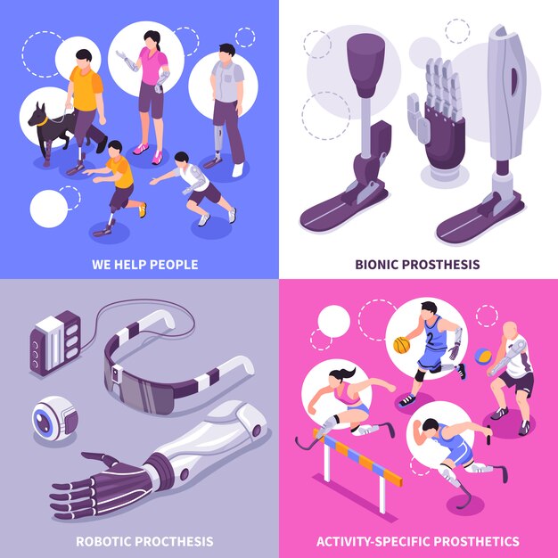Concepto isométrico de prótesis biónica