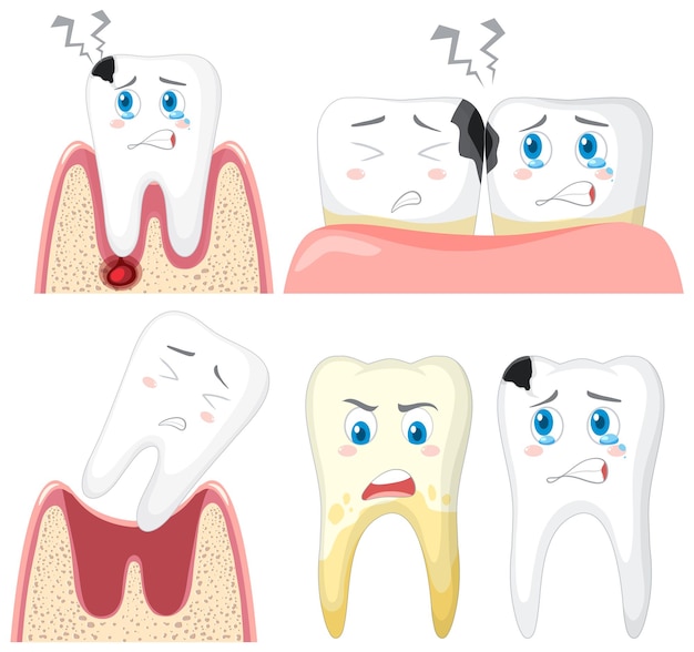 Vector gratuito conjunto de caries dental sobre fondo blanco.