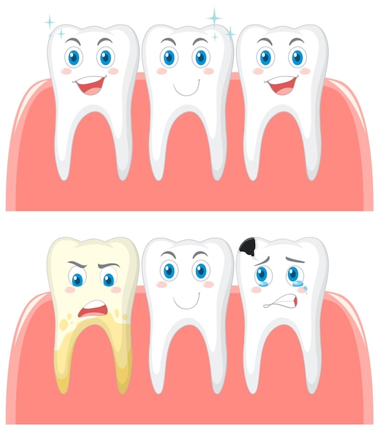 Vector gratuito conjunto de dientes fuertes y caries sobre fondo blanco