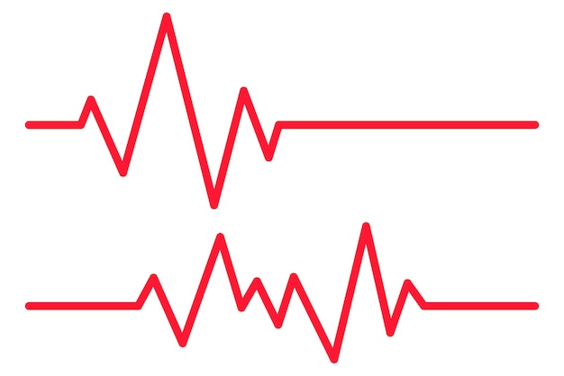Conjunto de latidos del corazón de dos líneas de Ecg