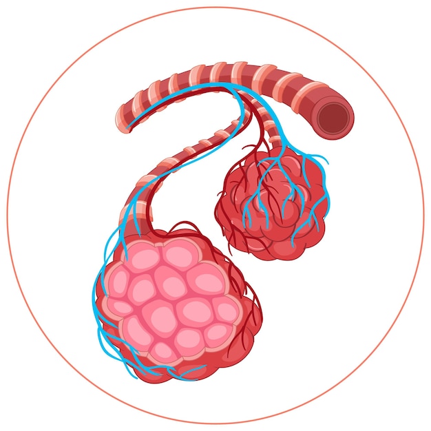 Diagrama de la enfermedad en los pulmones humanos