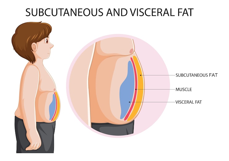 Vector gratuito diagrama de grasa subcutánea y visceral