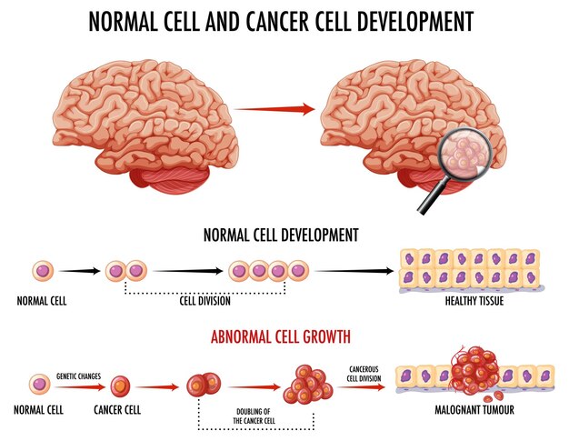 Diagrama que muestra una célula normal y una célula cancerosa