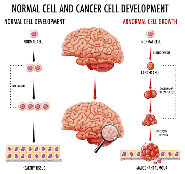 Vector gratuito diagrama que muestra una célula normal y una célula cancerosa