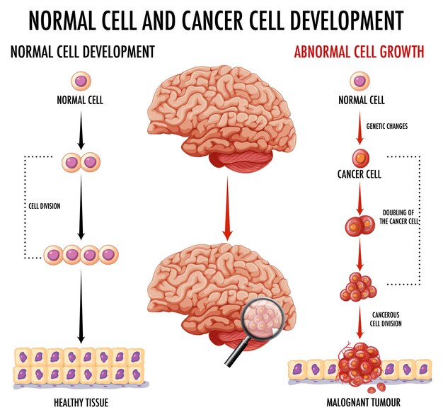 Diagrama que muestra una célula normal y una célula cancerosa