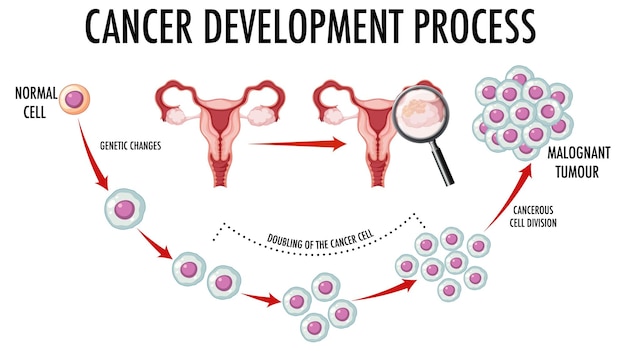 Diagrama que muestra células normales y cancerosas en humanos