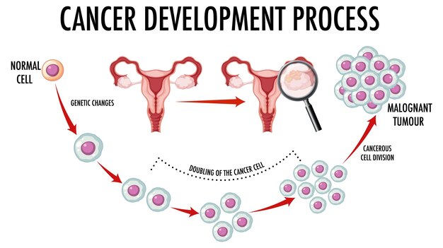 Diagrama que muestra células normales y cancerosas en humanos