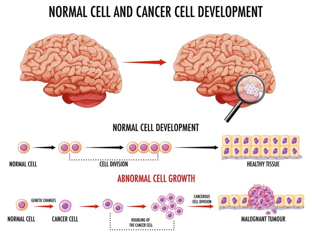 Diagrama que muestra células normales y cancerosas en humanos