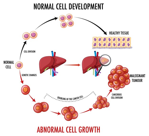 Diagrama que muestra células normales y cancerosas en humanos