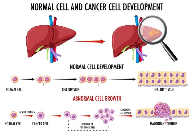 Diagrama que muestra células normales y cancerosas