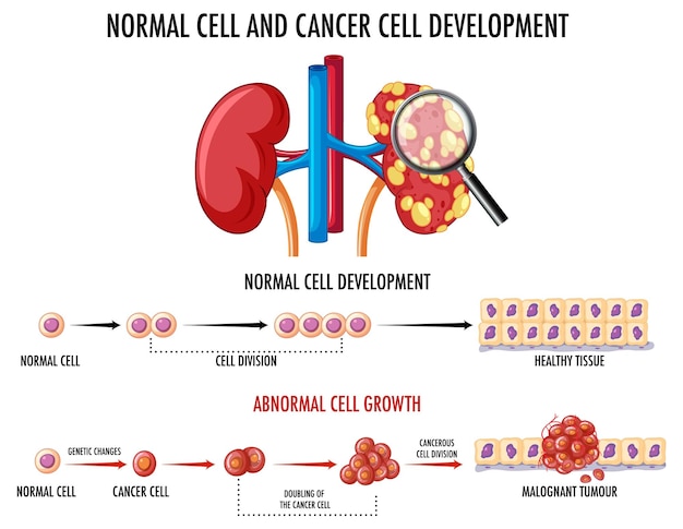 Vector gratuito diagrama que muestra células normales y cancerosas