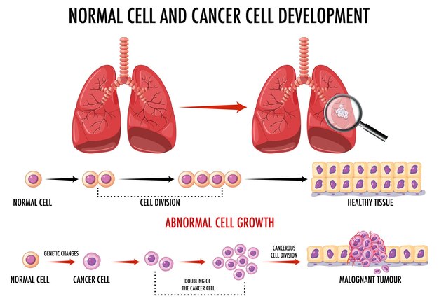 Diagrama que muestra células normales y cancerosas