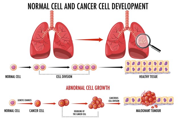 Diagrama que muestra células normales y cancerosas
