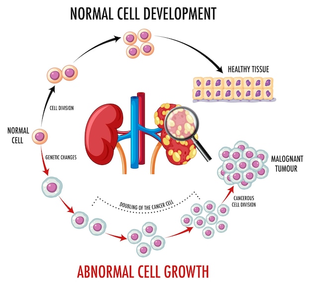 Diagrama que muestra células normales y cancerosas