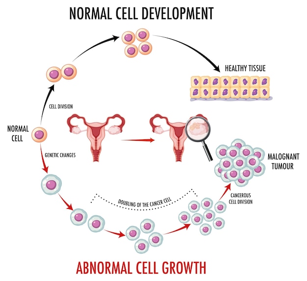 Diagrama que muestra células normales y cancerosas