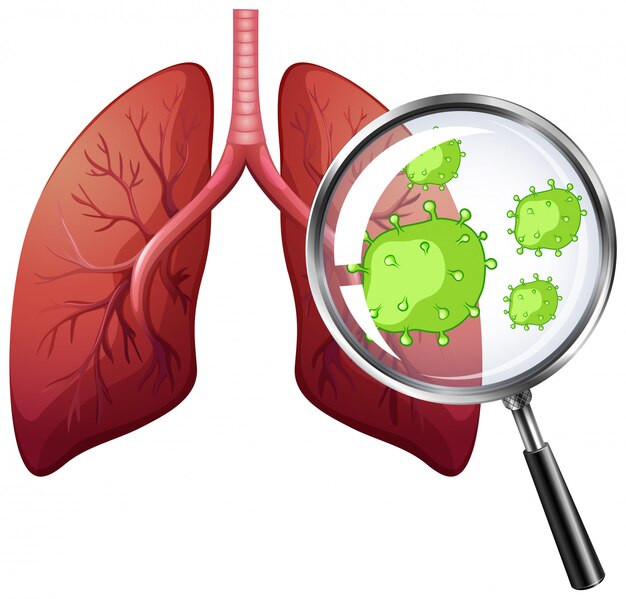 Diagrama que muestra células virales en pulmones humanos