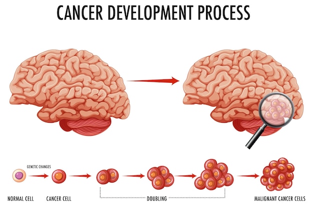 Vector gratuito diagrama que muestra el cerebro humano y el cáncer