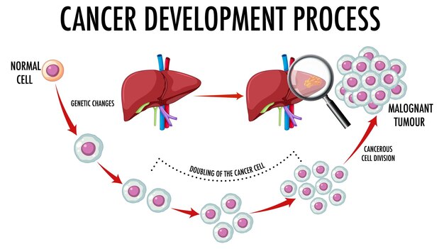 Diagrama que muestra el proceso de desarrollo del cáncer