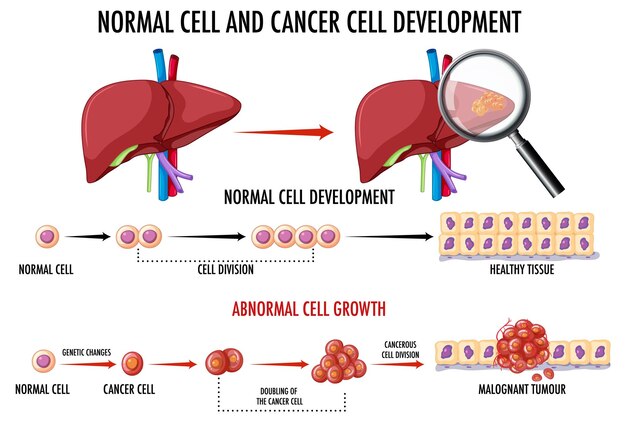 Diagrama que muestra el proceso de desarrollo del cáncer