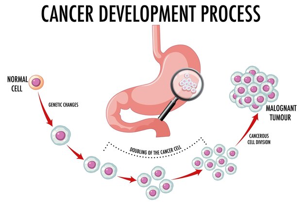 Diagrama que muestra el proceso de desarrollo del cáncer