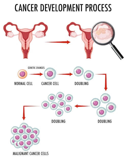 Vector gratuito diagrama que muestra el proceso de desarrollo del cáncer