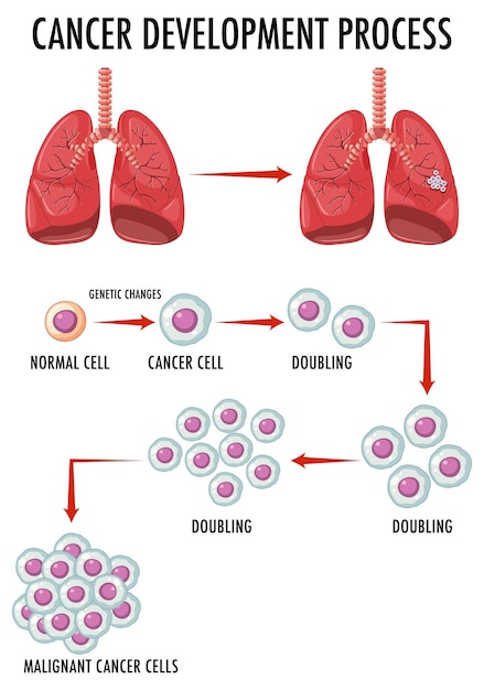 Vector gratuito diagrama que muestra el proceso de desarrollo del cáncer