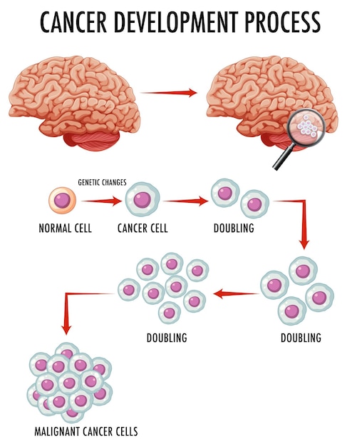 Diagrama que muestra el proceso de desarrollo del cáncer