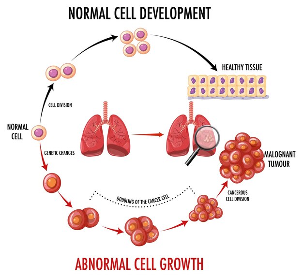 Diagrama que muestra el proceso de desarrollo del cáncer