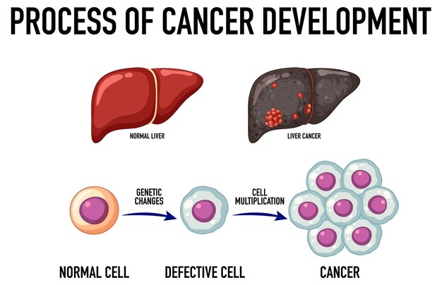 Diagrama que muestra el proceso de desarrollo del cáncer