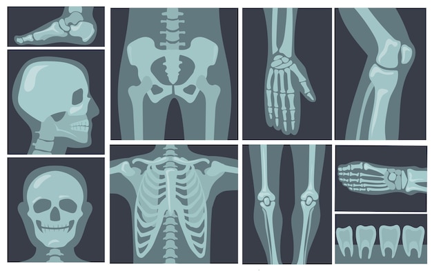 Vector gratuito disparos de rayos x del cuerpo humano.