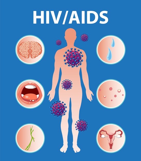 Efectos del virus VIHSIDA en el sistema inmunológico y el cuerpo