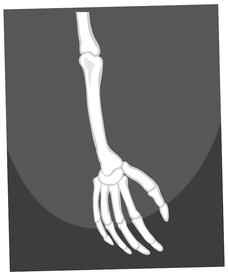 Vector gratuito esqueleto de brazo y mano.